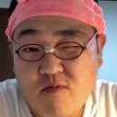 1050 | 모우림의원(압구정)_1050모낭 모발이식 내돈내산 후기