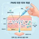 양주옥정피부과 리쥬란 아픈데 왜 맞을까?