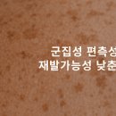 흑자 제거, 레이저 (편측성 군집성 흑자증 ). 이미지