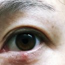 열린안과의원 이미지