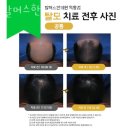 CU  신정중앙로점 | 양천구 신정동 한의원 발머스한의원 목동 위치 오는길 후기