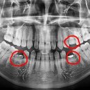 송플란트치과의원 이미지