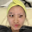 씨유하남미사점 | 솔에스테틱 하남미사점 _ 미사피부관리, 여드름압출 등 내돈내산 에스테틱샵 후기