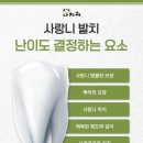 중동열린치과의원 | 창원중동치과 사랑니 발치 후 주의 사항 확인하세요