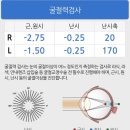 밝은성모안과의원 | 밝은성모안과의원 라섹 일기😎😎