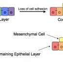 Epithelial-mesenchymal transition 간엽세포 이행 - 암전이의 핵심어 이미지