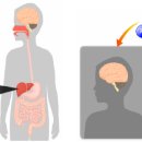 뇌종양(뇌암) 치료식 / 항암제, 방사선 치료 부작용을 피하는 케톤식이(ketogenic diet) 이미지