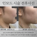 스노우의원 이미지