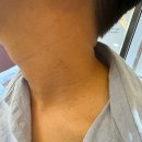 (주)브이아이피 응급환자이송센터 | [일상]5월 첫째주-성남 점빼기 병원 추천, 간파게티, 곱창 또또방문 내돈내산 맛집