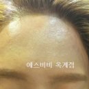 비비헤어라인