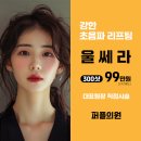 울쎄라리프팅 300샷 가격 이미지