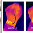 동아의료기기 이미지