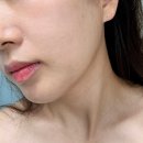 두정고시텔 - 천안시 서북구 원두정8길 32 | 두정동피부관리 신현호 메디에틱에서 받은 모공재생관리 솔직후기