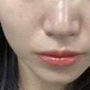 쁨글로벌의원 이미지