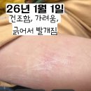 아이들이 하도 긁어서 개발한, 진주알 우아본크림 나눔합니다~ 이미지