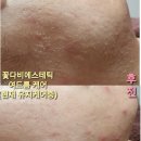 꽃다비 에스테틱 이미지