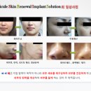 지니솔루션