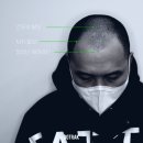 도트락강서점 | 도트락 강서점/두피문신 디자인/두피문신후기/두피문신전후비교/smp전후/마곡두피문신/강서두피문신...