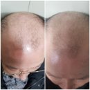 Hair growth products 이미지