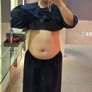 신도림 복부지방추출주사 당일 + 1주차 후기