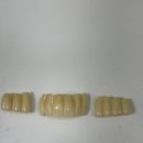 커스텀기공소 이미지