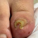 푸스케어 부산당감점 쿤스트뷰티 이미지