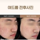 아그네스 이미지