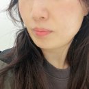 [안산/고잔동] 뷰티인사이드안산 고잔동피부관리 웨딩촬영 전 꿀팁 스킨플래닝 후기