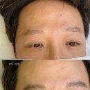 착한헤어 - 고양시 일산서구 | [동탄병점눈썹문신] 예전 실패한 붉은잔흔케어 복구, 착한눈썹 헤어스트록으로 완벽 극복한 찐 후기