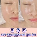 에스테틱고우다 | 대구 얼굴소멸관리 주1회 3주간 고우다에서 관리해 본 솔직후기