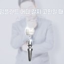 나비치과기공소 네이버블로그
