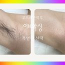 이브왁싱 부평점 네이버블로그