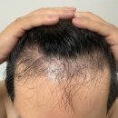 모바른의원 이미지