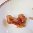 미광반점 이미지