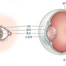 아이데코안경콘택트 이미지