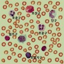 세균 방어 기전의 주역인 백혈구 이미지