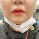 재생지압침술원 | 구안와사 지압침시술 치료 후기