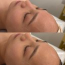 신명메디칼 | 영통 피부 맞춤형 디톡스 케어 (비포&amp;애프터) 올가드림뷰티 영통신나무실점