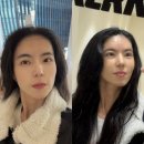 서울성형외과의원 | 역 리와인드 성형외과의원]이마필러 당일 후기/1:1 맞춤형 진료/리프팅/동안성형/안면거상술/쁘띠성형/