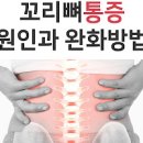 꼬리뼈가 아픈 이유 꼬리뼈 통증 치료 이미지