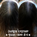 동구릉로6번길 | 구리 탈모 다닷SMP 정수리 1회차 후기