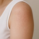 미피부과학 | 빛나는 피부의 완성은!모공각화부터 해결해야 합니다.