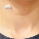 로지의원 | 출산 후 짙어진 목주름 관리 방법 이퀄로지 목주름 세럼 솔직후기