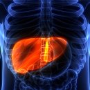 지방간의 진단과 관리 이미지