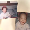 [이수 헤어라인] 혜민웨이_저, 이제 자신 있게 머리 올려요. (쌩얼 놀람주의)