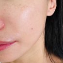 남은약국 | 도미나기미크림 약국기미크림 찐 후기 사용법 저도 몰랐었어요