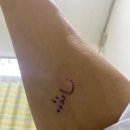 왕천파닭괴산점 | ERCP 후 담낭제거, 충북대학교병원 담낭제거 수술 후기