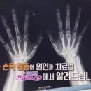 손·손목 통증의 원인과 치료법 [101세의프러포즈] 이미지