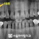 서울하이탑치과의원 이미지
