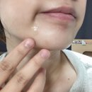 진메디케어 이미지